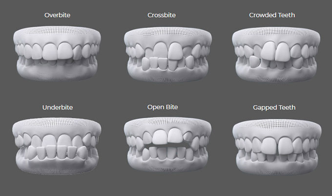 teeth examples