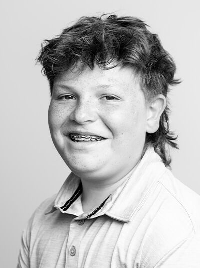 braces invisalign cost